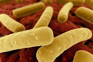Clostridium difficile (C. difficile) are anaerobic bacteria. This means they do not need oxygen to survive and multiply